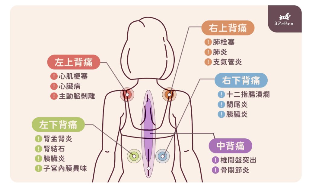 背部疼痛區域圖-遠端症狀效應導致的背痛位置以及可能原因