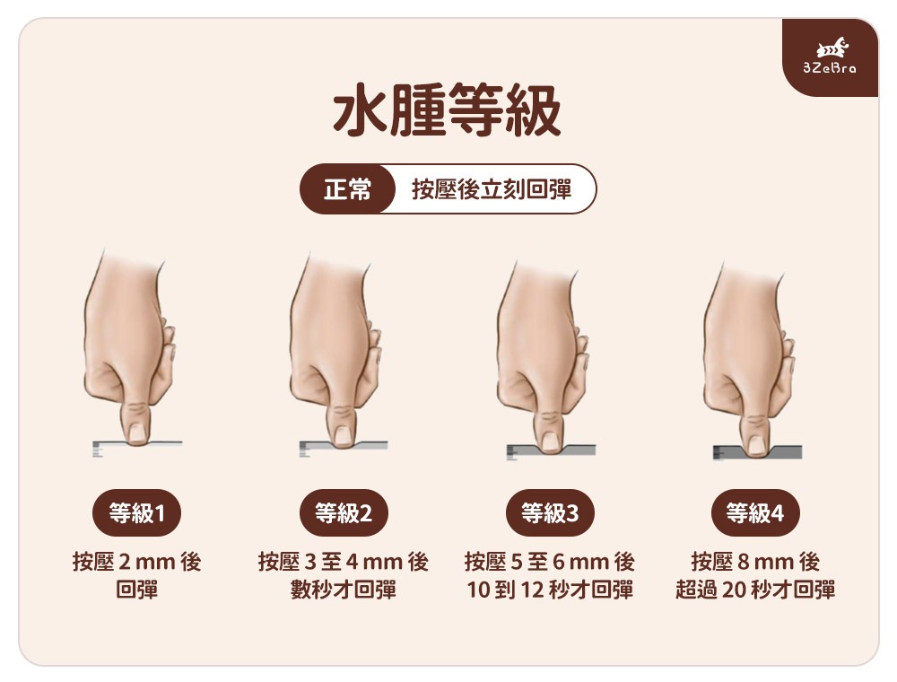 小腿水種