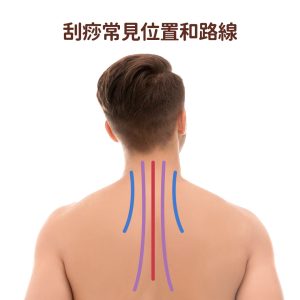 刮痧位置全攻略：6個刮痧位置功效與13個刮痧小功效 - 【3ZeBra】三隻斑馬