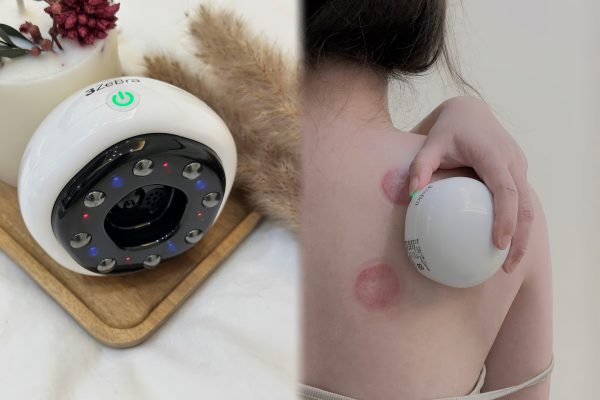拔罐好處：【3ZeBra】舒浮罐︱智能負壓刮痧拔罐器