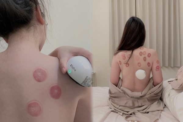 拔罐禁忌-【3ZeBra】舒浮罐︱智能負壓刮痧拔罐器