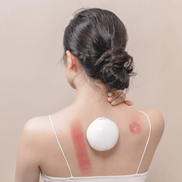 想在家拔罐,工具是否「容易上手」決定體驗好壞,3Zebra 舒浮罐 是很多人推薦的居家工具