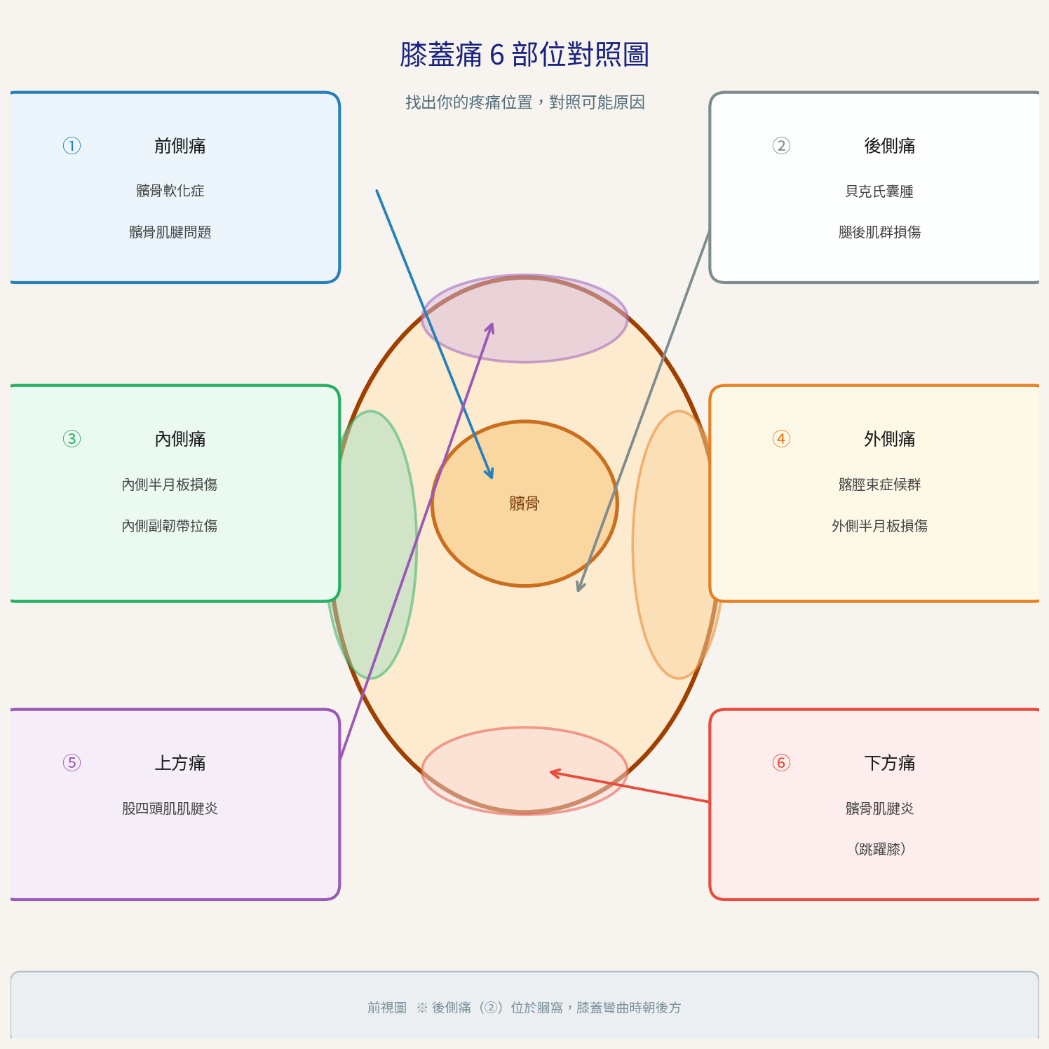 膝蓋痛原因：6個部位疼痛位置對照圖，前側、後側、內側、外側、上方、下方